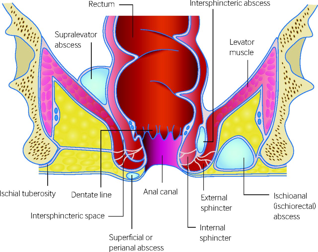 abscess-peri-anal-healthy-gut